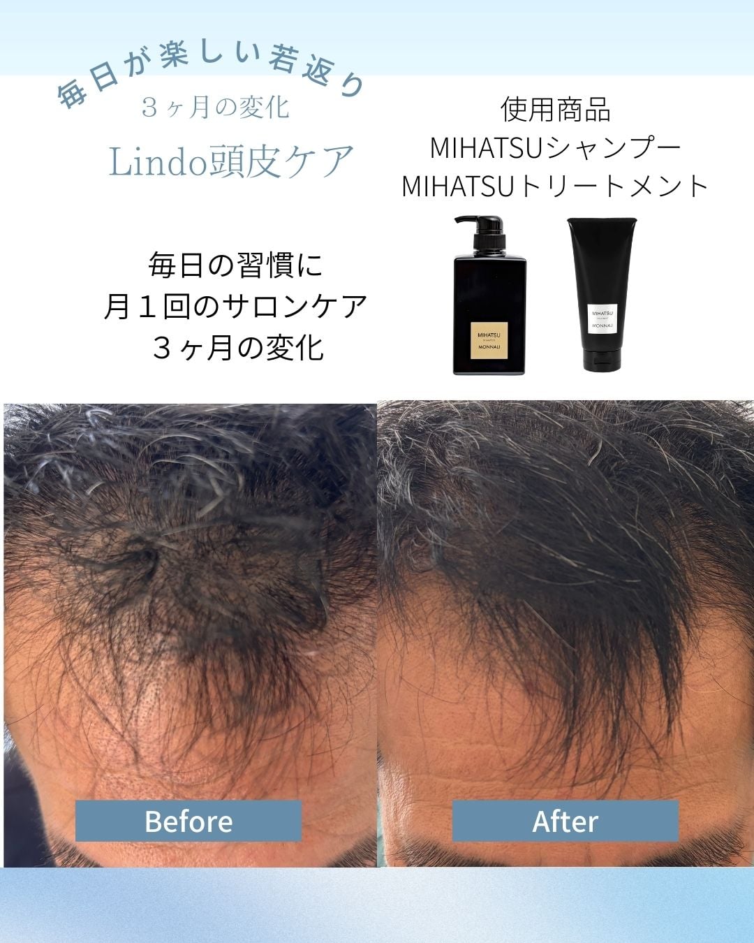 毎日の習慣と月1回のサロンケアによる3ヶ月の変化