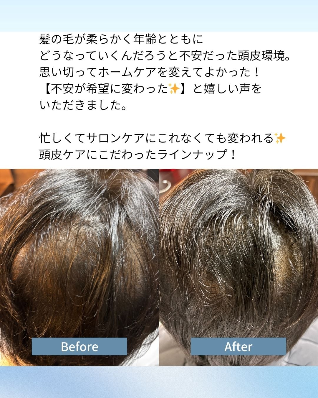 頭皮ケアを続けたお客様の頭頂部のビフォーアフター